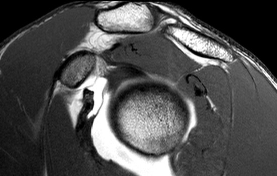 • Musculoskeletal MR arthrography