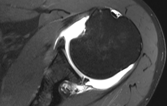 • Musculoskeletal MR arthrography