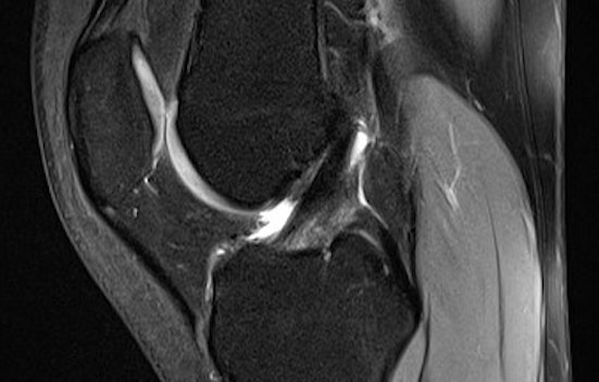 Musculoskeletal MRI scans