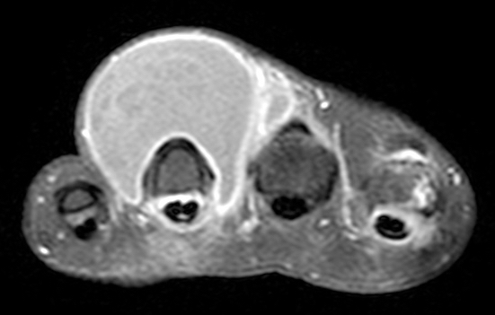 Musculoskeletal MRI scans