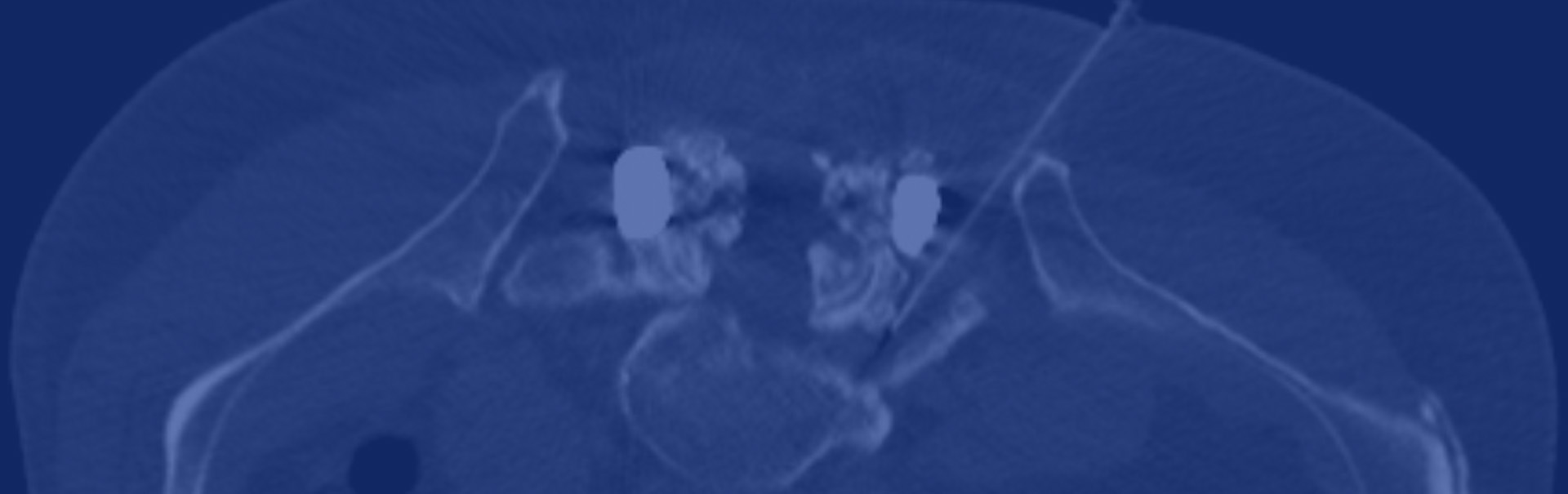 Title Image