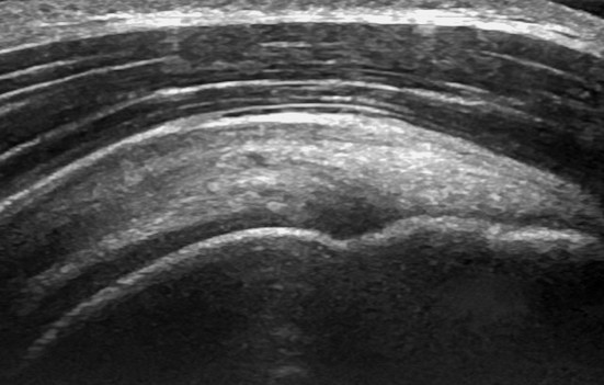 Ultrasound