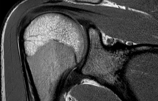 MRI