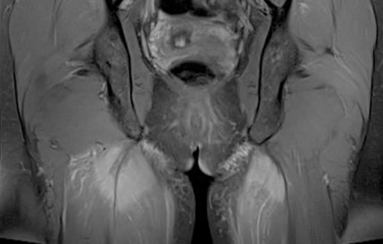 Sports imaging
